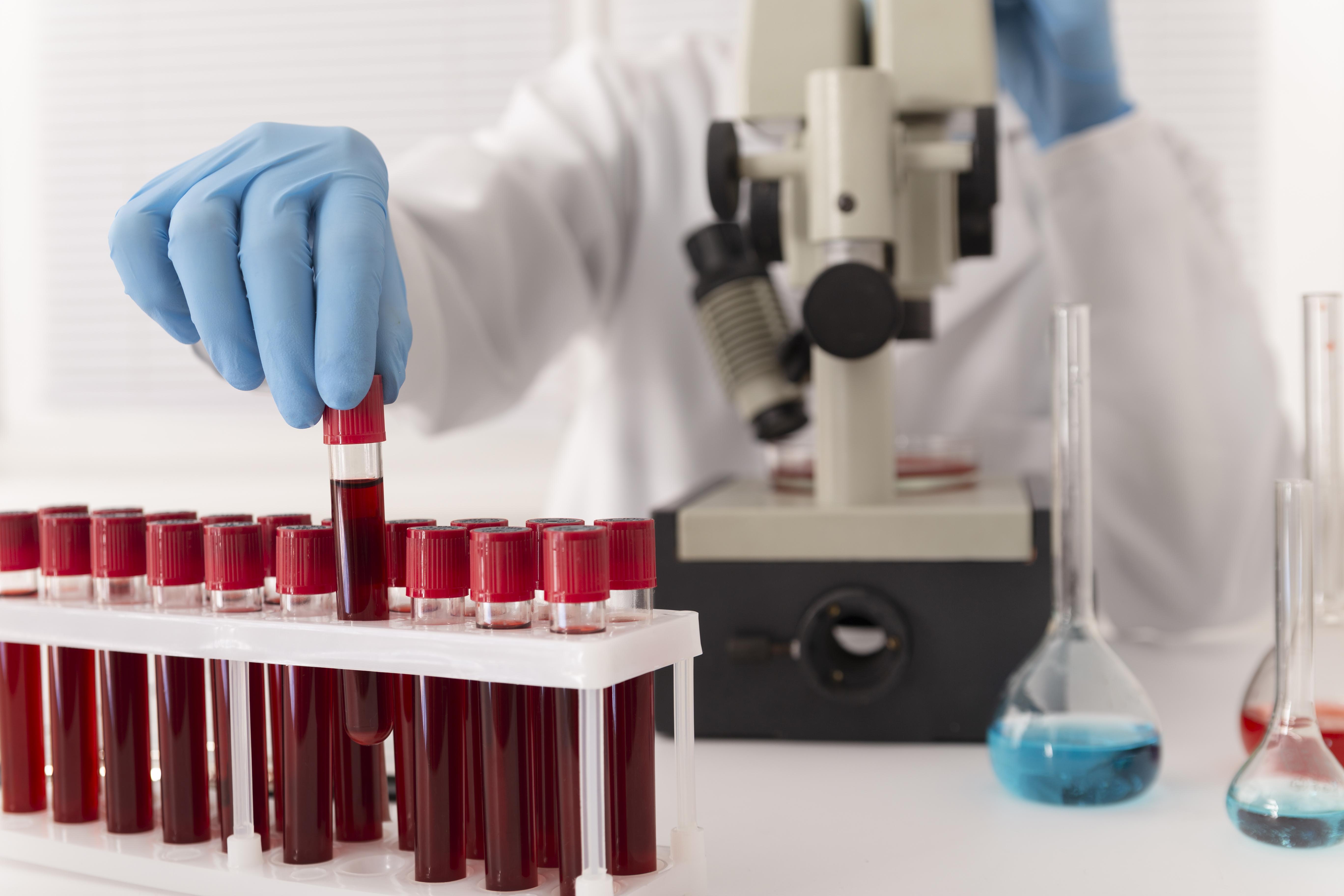 Anemia: o que é e como identificar? 